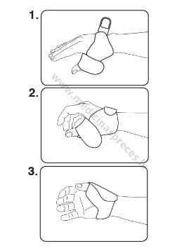 Īkšķa ortoze slēpotāja īkšķim (Skier's thumb)