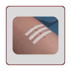 Brūču slēdzējsloksnītes